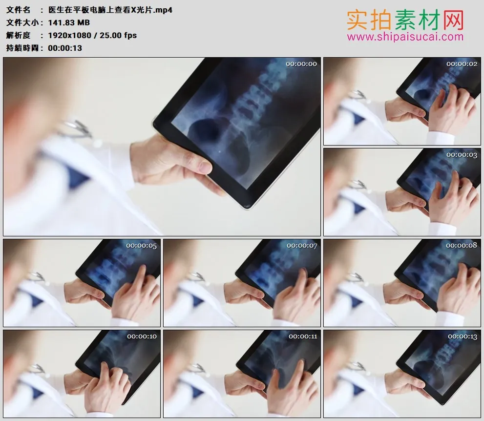 高清实拍视频素材丨医生在平板电脑上查看X光片