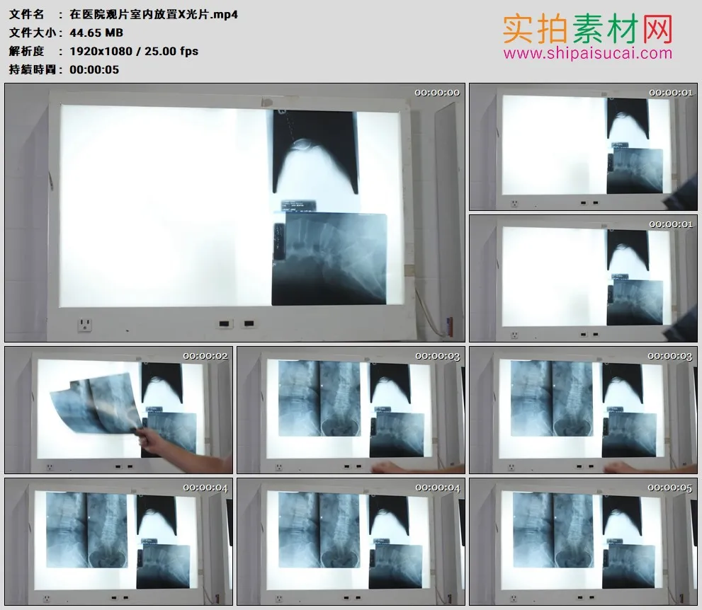 高清实拍视频素材丨在医院观片室内放置X光片