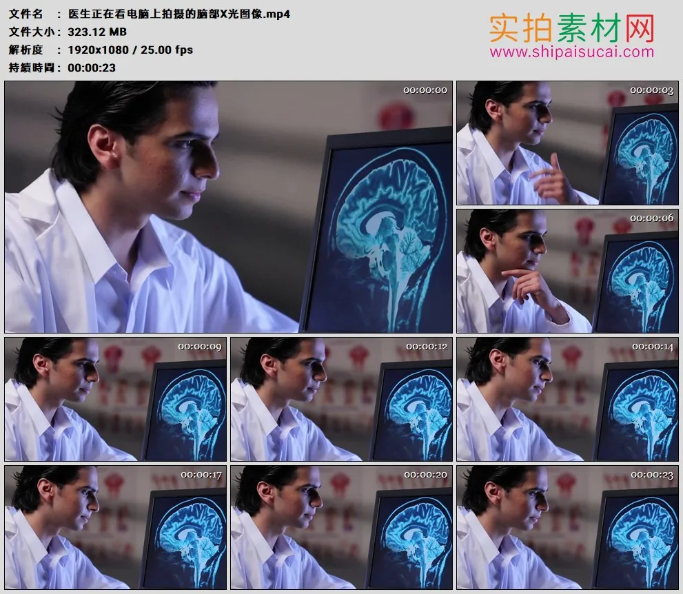 高清实拍视频素材丨医生正在看电脑上拍摄的脑部X光图像