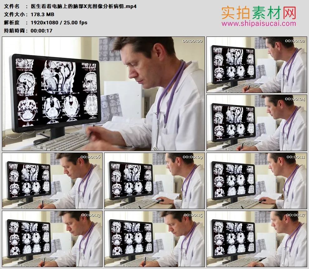 高清实拍视频素材丨医生看着电脑上的脑部X光图像分析病情