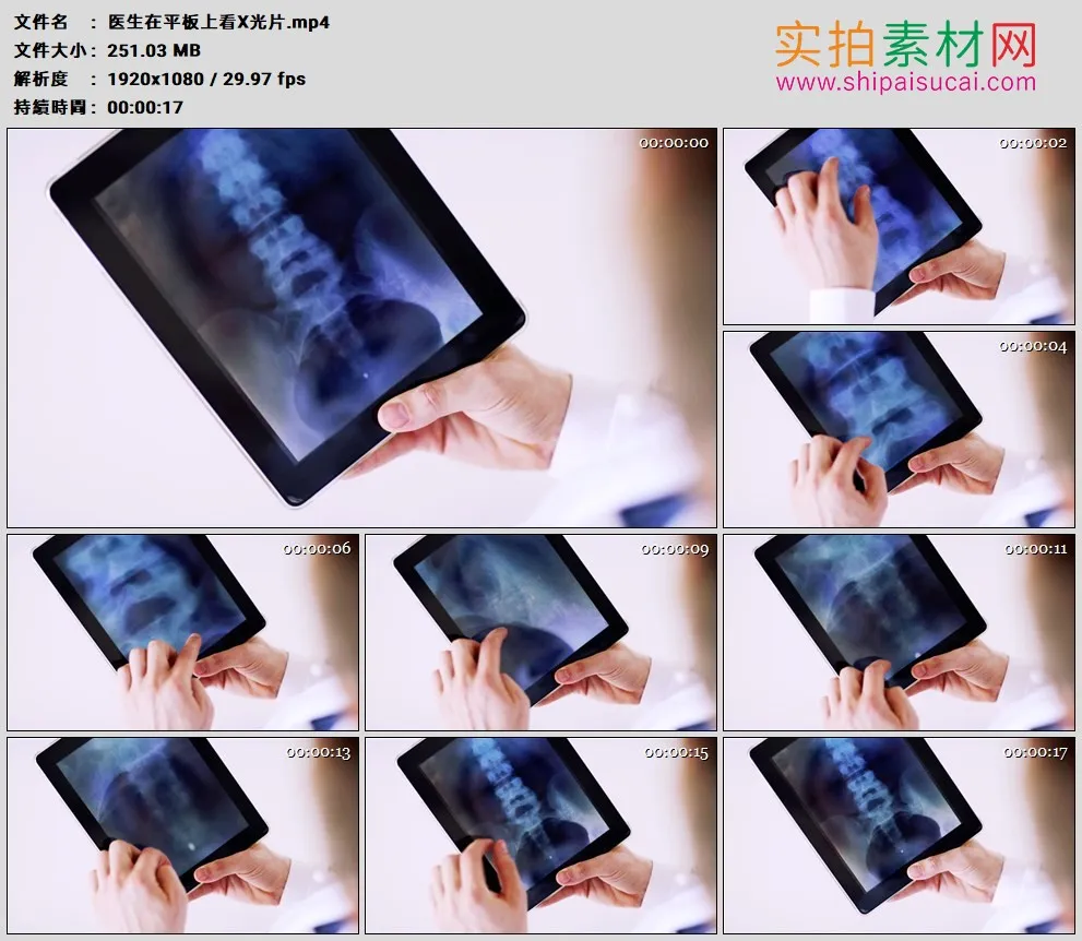高清实拍视频素材丨医生在平板上看X光片