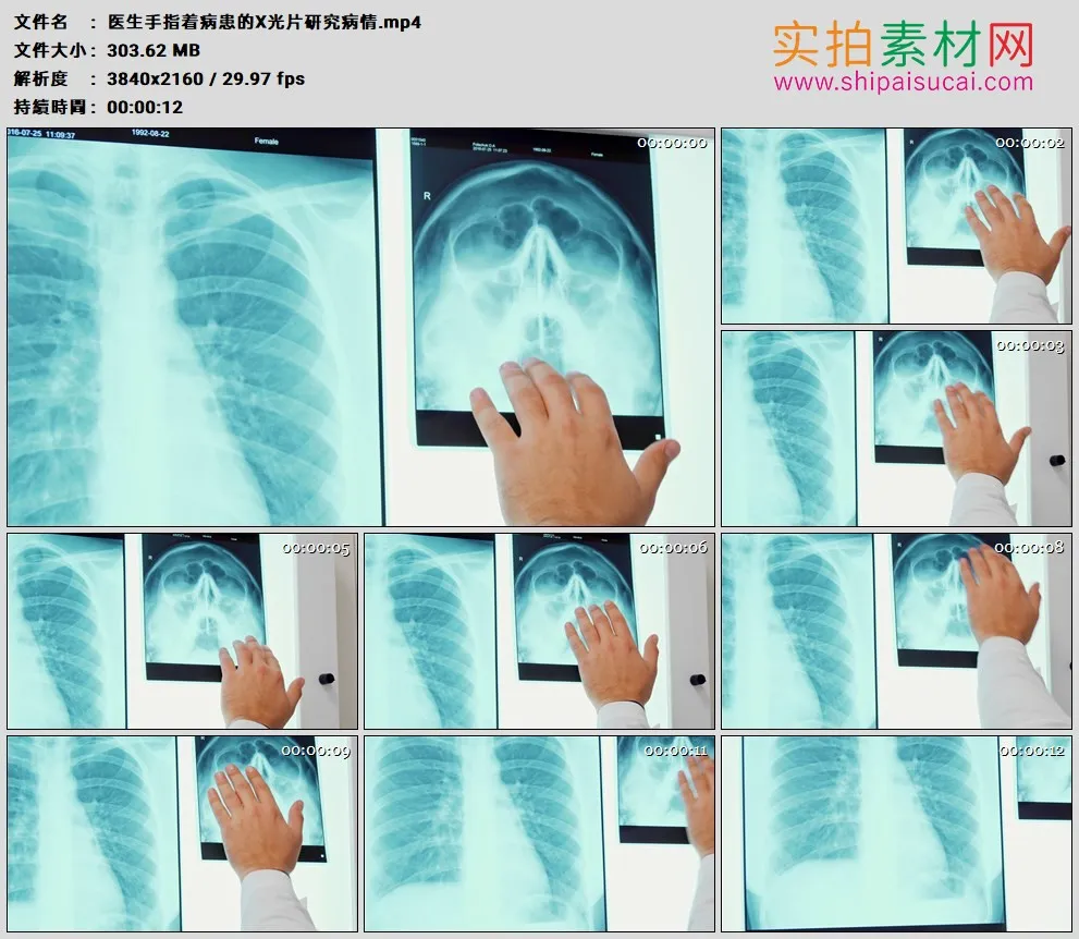 4K高清实拍视频素材丨医生手指着病患的X光片研究病情