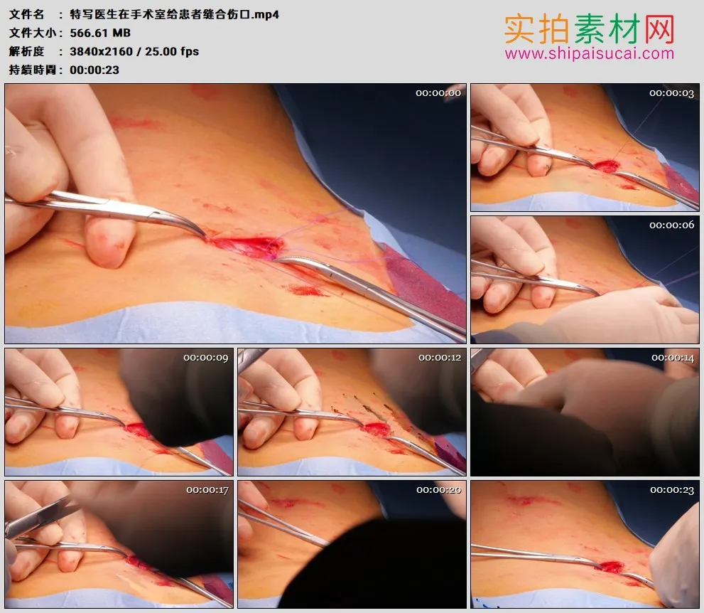 4K高清实拍视频素材丨特写医生在手术室给患者缝合伤口