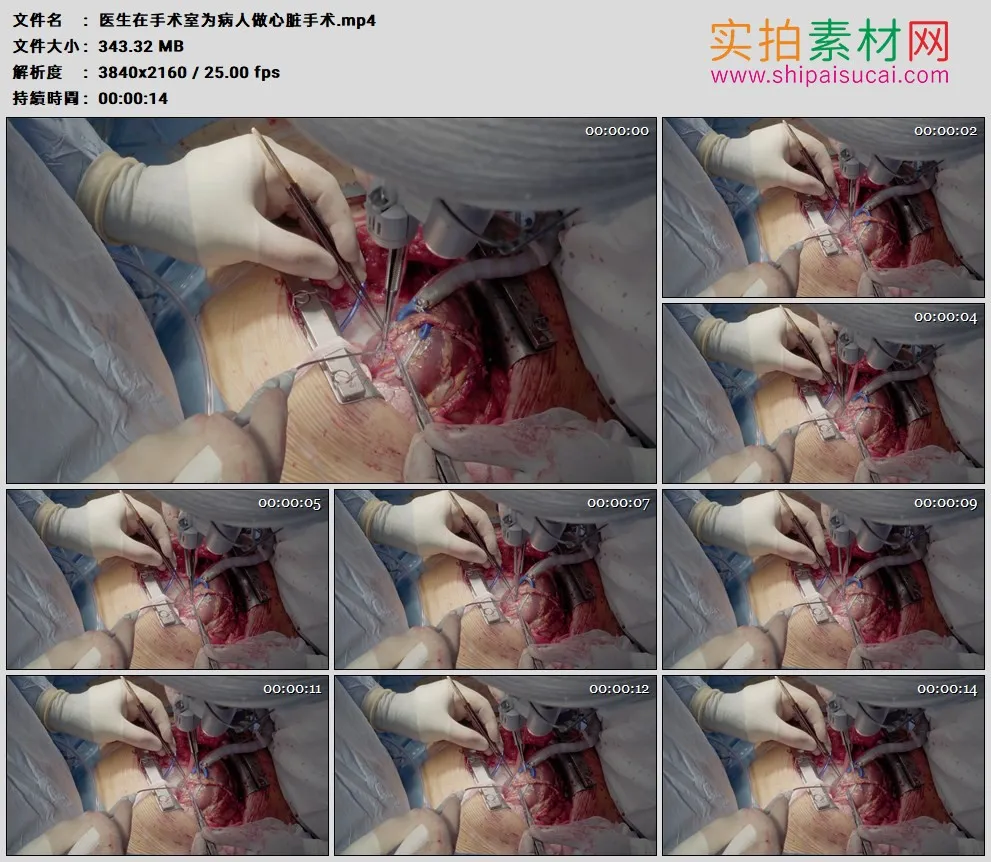 4K高清实拍视频素材丨医生在手术室为病人做心脏手术
